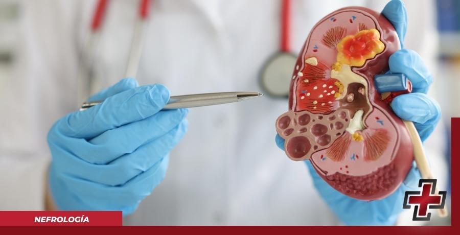 NEFROLOGIA