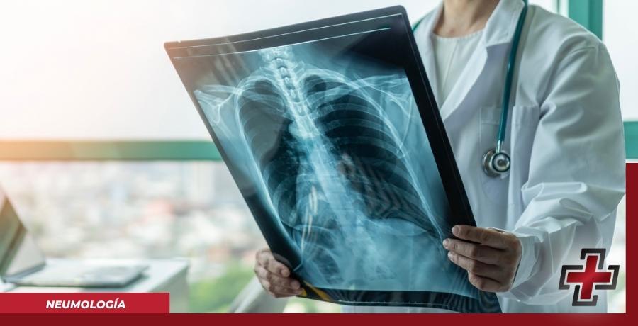 NEUMOLOGIA